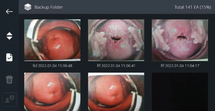 Cerviray_App_29_Backup_Folder